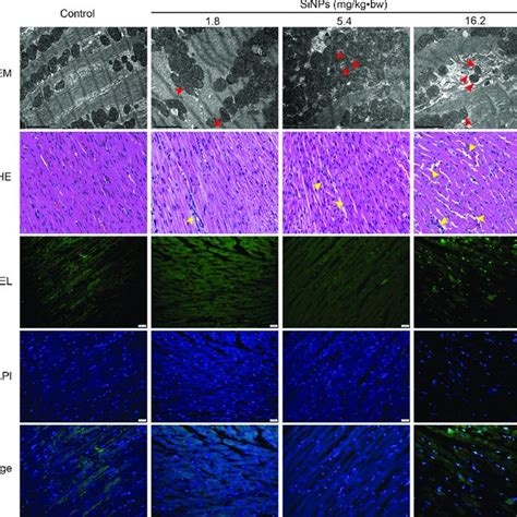 Ultrastructural Pathological Changes And Myocardial Apoptosis Induced