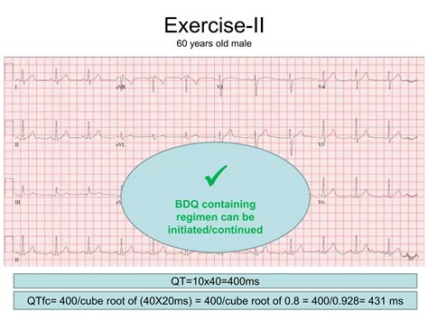 Excercise Corrected Qt Interval Q Tc Ecg Interpretation Ppt