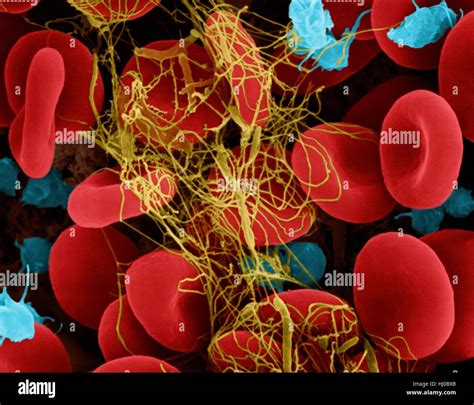 Human Red Blood Cells Activated Platelets Trapped In Fibrin Blood Clot