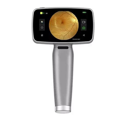 Hospital Medical Ophthalmology Handheld Retinal Camera Test Digital