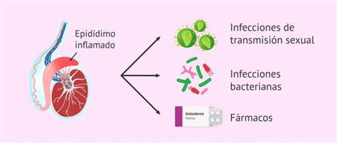 Infecciones Del Líquido Seminal Orquitis Epididimitis Y Prostatitis