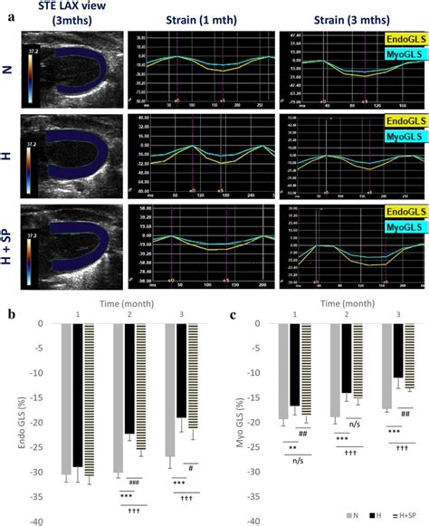 Global Longitudinal Strain Analysis Global Longitudinal Strain Gls