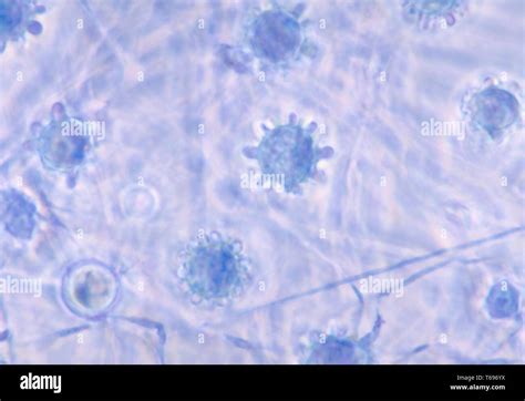 Microfotografía De Las Múltiples Macroconidia Del Hongo Histoplasma Capsulatum 1963 Imagen