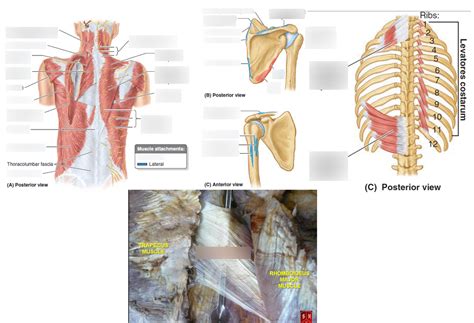 Extrinsic Back Muscles Anatomy Diagram Quizlet