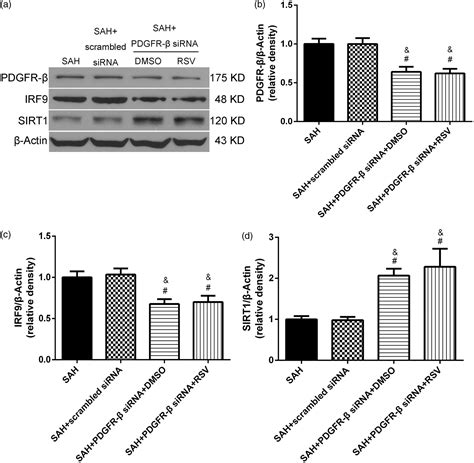 Pdgfr β Modulates Vascular Smooth Muscle Cell Phenotype Via Irf 9sirt