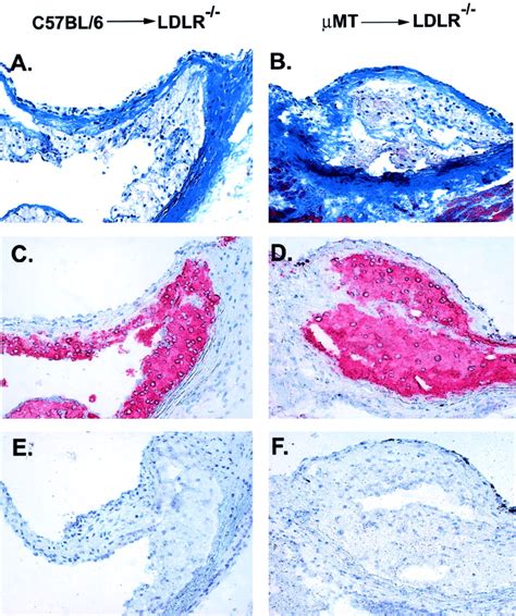 B Lymphocyte Deficiency Increases Atherosclerosis In Ldl Receptornull