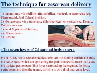 Cesarean Section Ppt