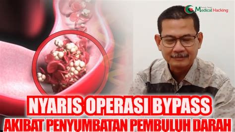 Jangan Dulu Bypass Jantung Lakukan Treatment Ini Medicalhacking