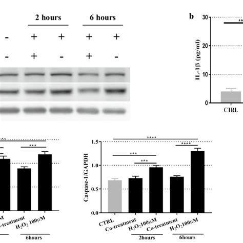 13 MB Inhibits NLRP3 Inflammasome Activation In HUVECs A The