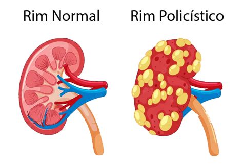 Rins Polic Sticos Como Deve Ser A Alimenta O B Rbara Martini