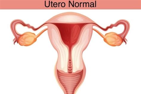 Adenomiose O Que Sintomas E Poss Veis Causas Tua Sa De