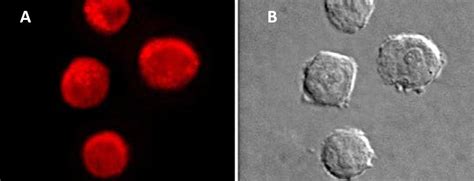 Magic Red® Fluorescent Cathepsin K Assay Kit