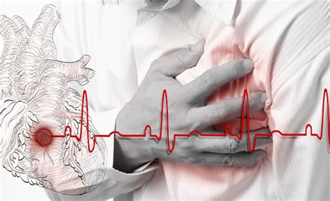 O Que É Parada Cardiorrespiratória Enfermagem Florence