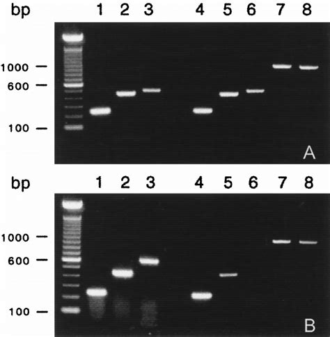 A Rt Pcr Expression Analysis Of Ob Ra And Ob Rb Isoforms In Rat Brain