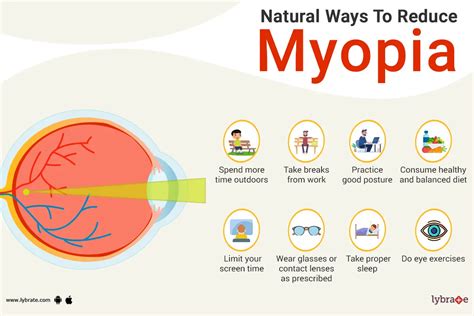 8 Ways to Reduce Myopia Naturally - By Dr. Sharad Pandit | Lybrate