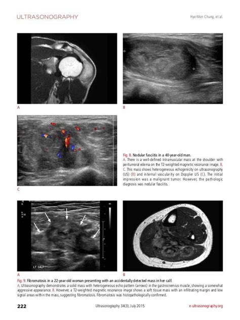 Diagnostic Ultrasound soft tissue