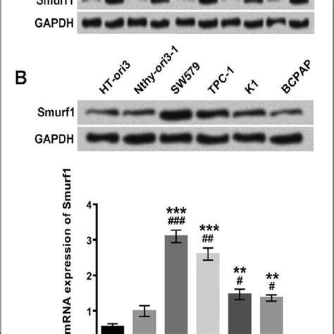 Smurf Was Highly Expressed In Thyroid Tumor Tissues And Thyroid Cancer