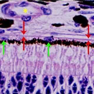 Transmission electron microscopy of the RPE-Bruch... | Download ...