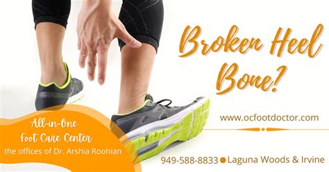 Broken Heel Bone