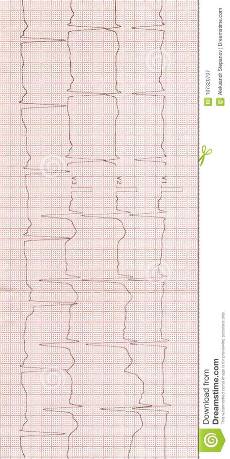 Electrocardiogram On A Red Paper Tape Background Stock Image Image