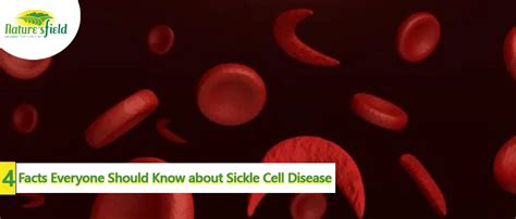 4 Facts Everyone Should Know About Sickle Cell Disease Naturesfield