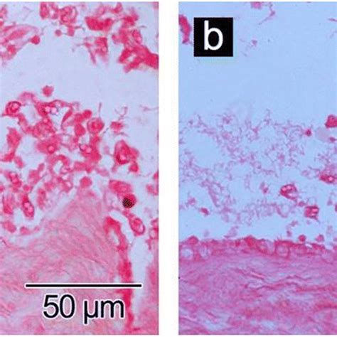 Myxospores And Developmental Stages Of Ceratomyxa Xanthopteri N Sp A