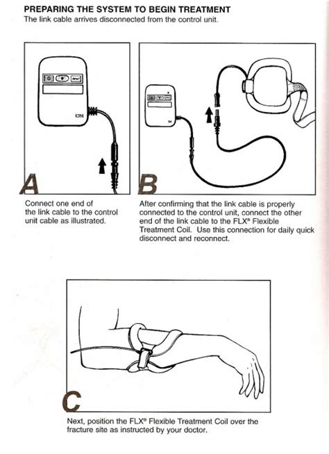 Bone Healing With Ebi Bone Growth Stimulator Hubpages