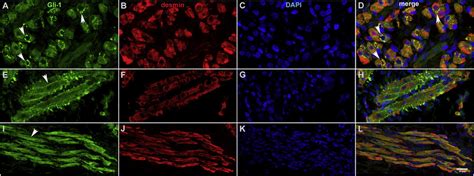 Gli-1 expression in embryonic chick pectoralis muscles. Muscle ... 
