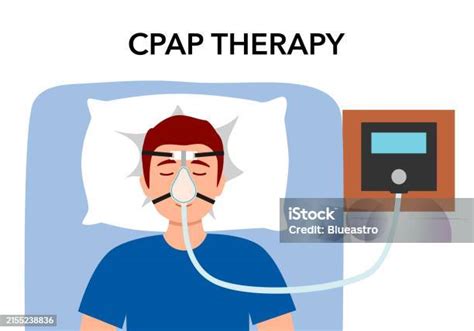 Man With Sleep Apnea Syndrome Wearing Cpap Machine In Flat Design Stock Illustration Download