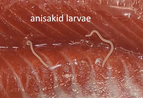 Creepy Dreadful Wonderful Parasites