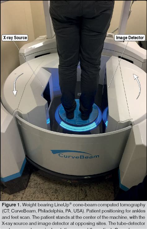 Figure 1 From Weight Bearing Cone Beam Ct Scans And Its Uses In Ankle