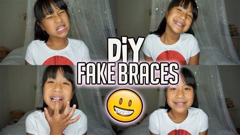 Diy Fake Braces Super Easy Trendy On Tik Tok Youtube