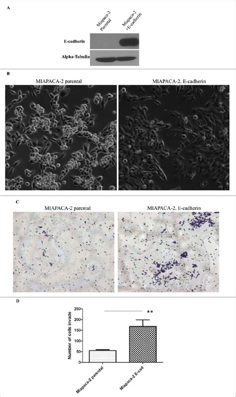 Ectopic Expression Of E Cadherin Increases The Epithelial Look Of The