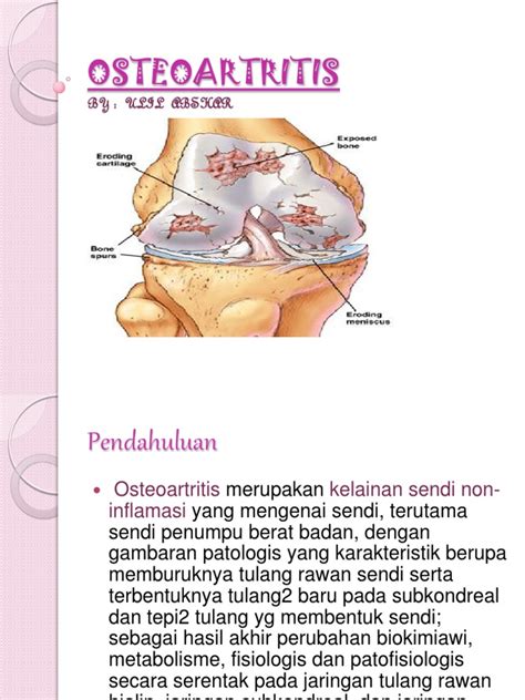 OSTEOARTRITIS | PDF