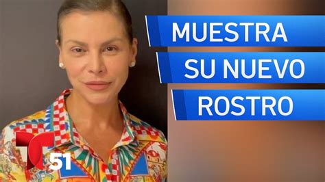 Olga Ta N Muestra Su Nuevo Rostro Tras Cirug A Acceso Total Youtube