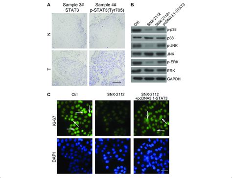 Stat Overexpression Reducing The Efficacy Of Snx A Stat