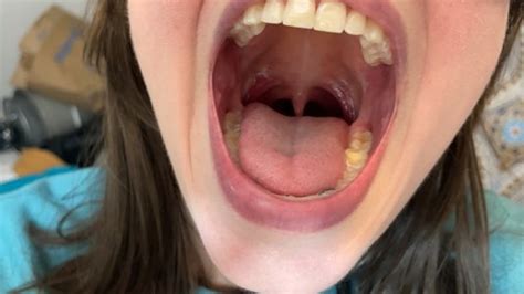 Mouth Fetish Porn Tube Video Clips Clips Sale