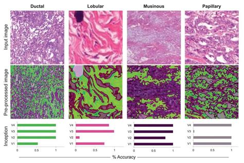 From Top To Bottom Histopathological Images As Input Data From