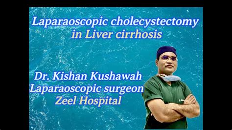 Laparoscopy Cholecystectomy In Liver Cirrhosis Patient Youtube