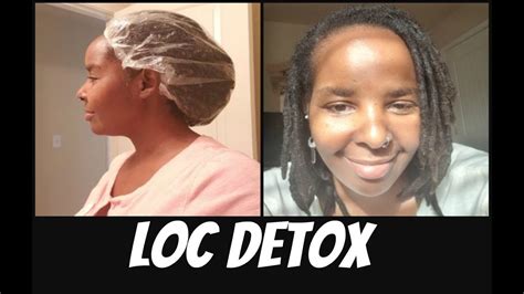 Acv And Baking Soda Loc Detox Buildup Removal Guaranteed Youtube