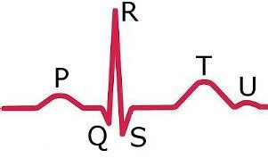 elements  ecg complex  scientific diagram