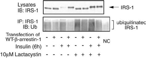 Effects Of Wild Type Arrestin 1 Overexpression On Insulin