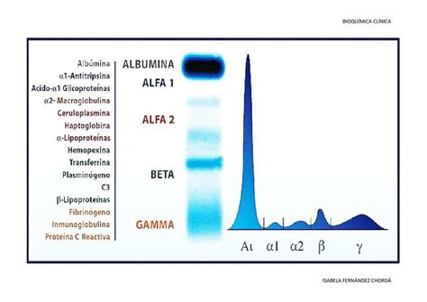 Tabla Proteínas plasmáticas Isabela Fernandez uDocz