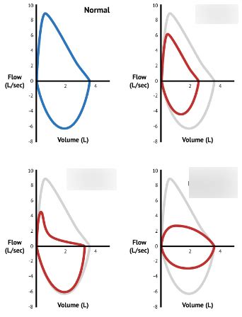 Diagram Of Pressure Flow Volume Loops Quizlet