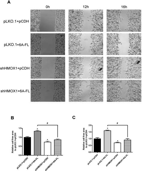 Migration Capability Evaluated By Wound Healing Assays A Download Scientific Diagram