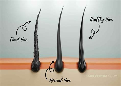 What Is Dead Hair And 7 Easy Ways You Can Bring Your Tresses Back To ...