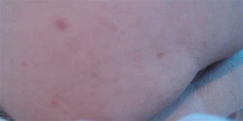 Anal Play And Prolapse Play HD Tnaflix