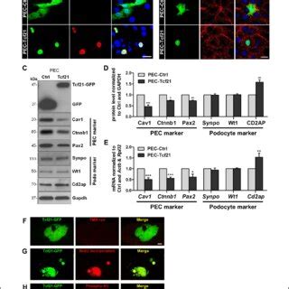 Effect of Tcf21 expression in PECs on PEC and podocyte markers. (A)... | Download Scientific Diagram