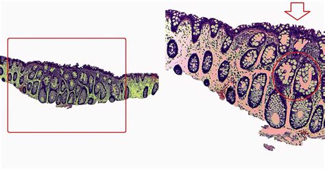 GASTROINTESTINAL AND LIVER HISTOLOGY PATHOLOGY ATLAS: COLON ...