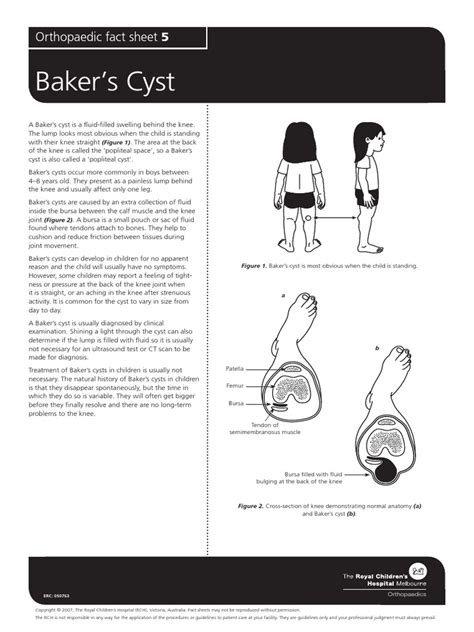 Bakers Cyst | PDF | Knee | Diseases And Disorders